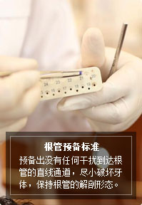 根管預(yù)備標(biāo)準(zhǔn)